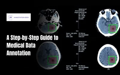A Step-by-Step Guide to Medical Data Annotation