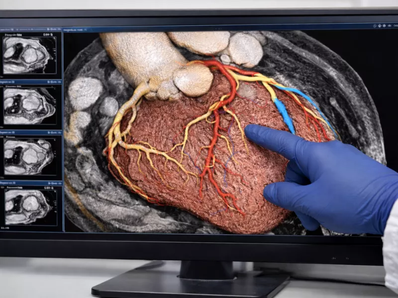 Doctor analyzing a 3D heart model using cardiovascular imaging AI software. Doctor analyzing a 3D heart model using cardiovascular imaging AI software.