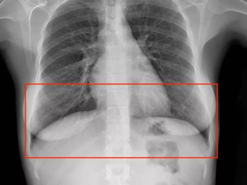 Landmark Image Annotation for Healthcare Landmark Image Annotation for Healthcare