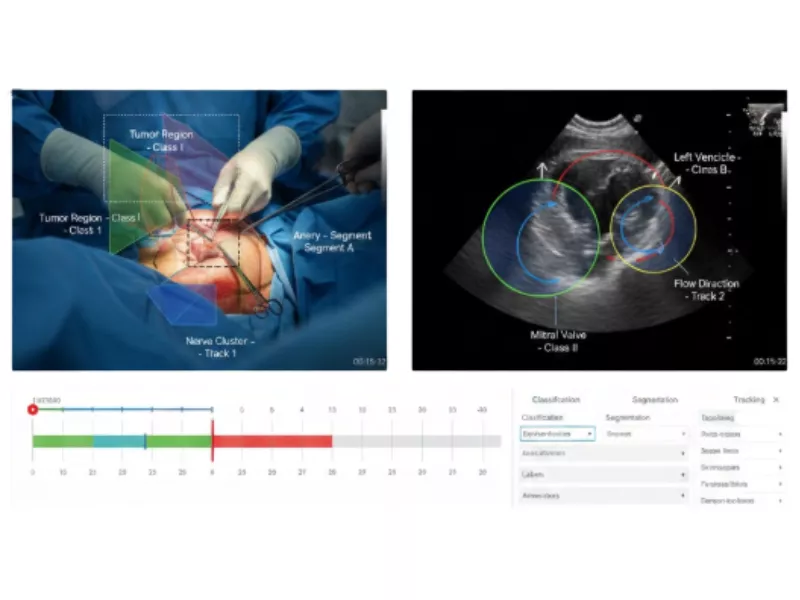 Image showing video annotation in surgical procedures, endoscopy videos etc Image showing video annotation in surgical procedures, endoscopy videos etc<br />