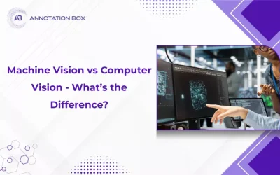 Machine Vision vs Computer Vision – What’s the Difference?